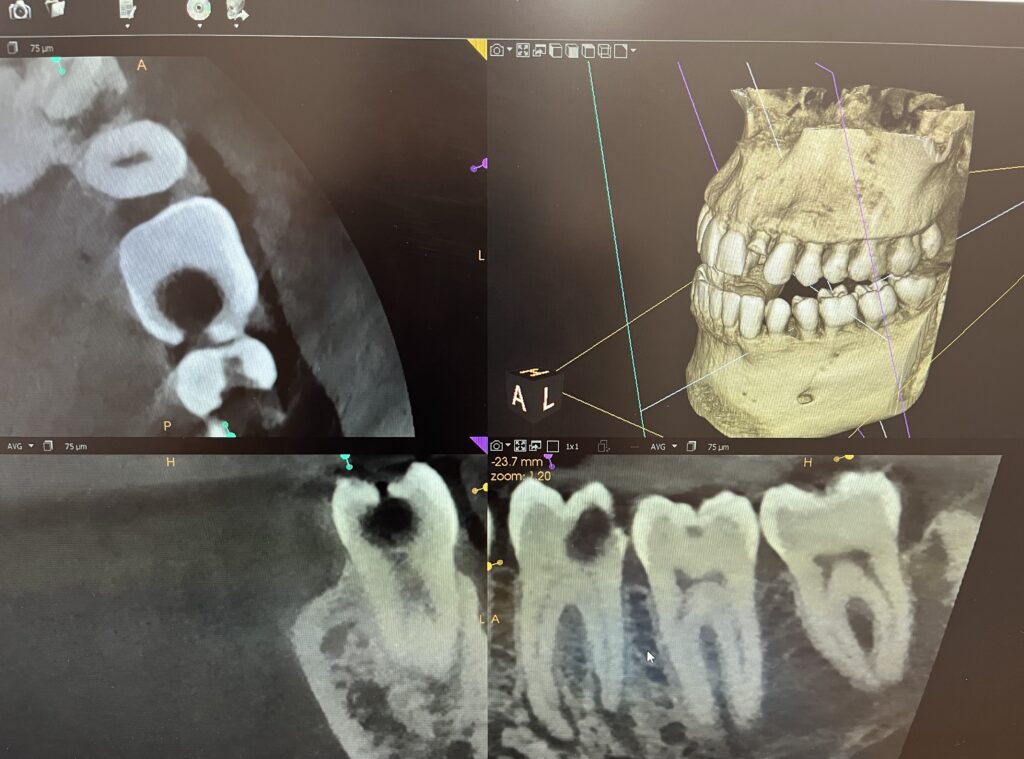 Sacramento Endodontics Imaging and X-Ray of Patient